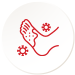 Fungal Infections